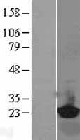 RBP4 Protein - Western validation with an anti-DDK antibody * L: Control HEK293 lysate R: Over-expression lysate