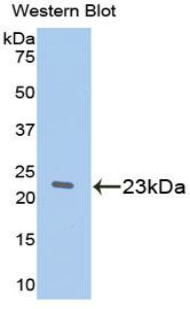 RBP5 Antibody - Western blot of recombinant RBP5.  This image was taken for the unconjugated form of this product. Other forms have not been tested.