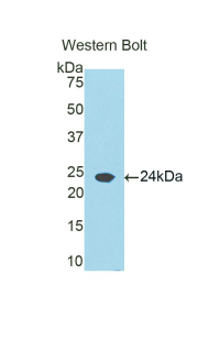RBP5 Antibody - Western blot of recombinant RBP5.  This image was taken for the unconjugated form of this product. Other forms have not been tested.