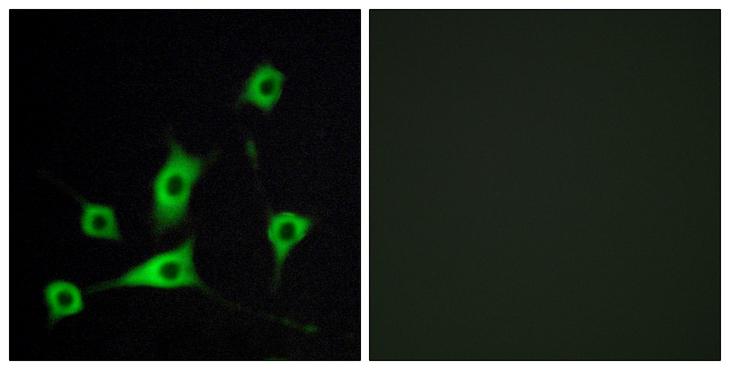RBP5 Antibody - Peptide - + Immunofluorescence analysis of LOVO cells, using CRBP III antibody.