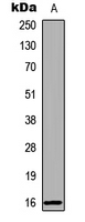 RBP5 Antibody - Western blot analysis of RBP5 expression in human liver (A) whole cell lysates.