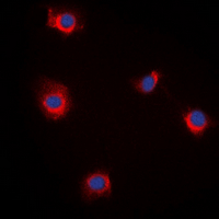 RBP5 Antibody - Immunofluorescent analysis of RBP5 staining in LOVO cells. Formalin-fixed cells were permeabilized with 0.1% Triton X-100 in TBS for 5-10 minutes and blocked with 3% BSA-PBS for 30 minutes at room temperature. Cells were probed with the primary antibody in 3% BSA-PBS and incubated overnight at 4 deg C in a humidified chamber. Cells were washed with PBST and incubated with a DyLight 594-conjugated secondary antibody (red) in PBS at room temperature in the dark. DAPI was used to stain the cell nuclei (blue).