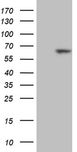 RBPJ Antibody - HEK293T cells were transfected with the pCMV6-ENTRY control. (Left lane) or pCMV6-ENTRY RBPJ. (Right lane) cDNA for 48 hrs and lysed. Equivalent amounts of cell lysates. (5 ug per lane) were separated by SDS-PAGE and immunoblotted with anti-RBPJ. (1:500)