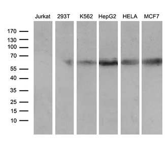 RBPJ Antibody - Western blot analysis of extracts. (35ug) from 6 different cell lines by using anti-RBPJ monoclonal antibody. (1:500)