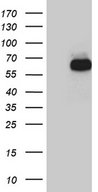 RBPJ Antibody - HEK293T cells were transfected with the pCMV6-ENTRY control. (Left lane) or pCMV6-ENTRY RBPJ. (Right lane) cDNA for 48 hrs and lysed. Equivalent amounts of cell lysates. (5 ug per lane) were separated by SDS-PAGE and immunoblotted with anti-RBPJ. (1:500)