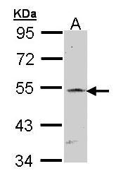 RBPJ Antibody - Sample (30 ug of whole cell lysate). A: Raji. 7.5% SDS PAGE. CBF1 / RBP-JK antibody diluted at 1:1000.