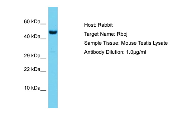 RBPJ Antibody -  This image was taken for the unconjugated form of this product. Other forms have not been tested.