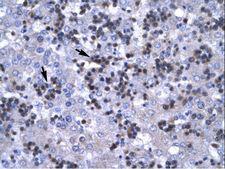 RBPJ Antibody - RBPJ antibody ARP31121_P050-NP_976028-RBPSUH Antibody was used in IHC to stain formalin-fixed, paraffin-embedded human liver.  This image was taken for the unconjugated form of this product. Other forms have not been tested.