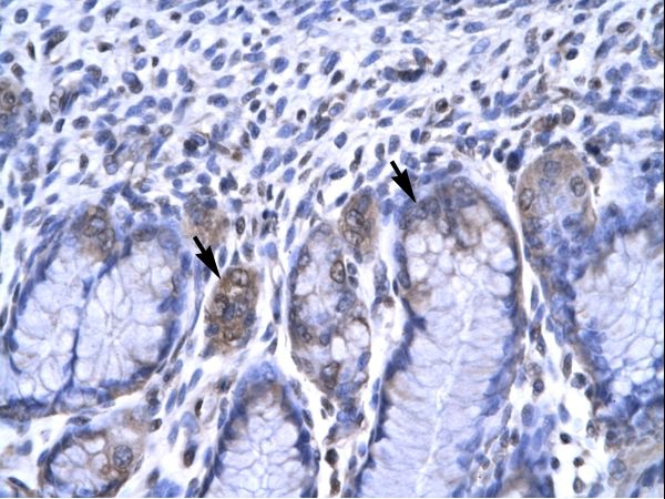 RBPJ Antibody - RBPJ antibody ARP31121_P050-NP_976028-RBPSUH Antibody was used in IHC to stain formalin-fixed, paraffin-embedded human stomach.  This image was taken for the unconjugated form of this product. Other forms have not been tested.