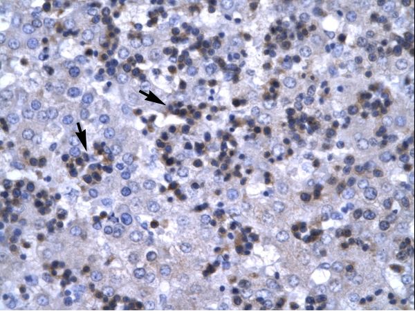 RBPJ Antibody - RBPJ antibody ARP31121_P050-NP_976028-RBPSUH Antibody was used in IHC to stain formalin-fixed, paraffin-embedded human liver.  This image was taken for the unconjugated form of this product. Other forms have not been tested.