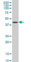 RBPJ Antibody - RBPJ monoclonal antibody (M01), clone 4E12 Western Blot analysis of RBPJ expression in Jurkat.