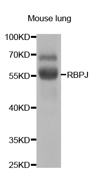 RBPJ Antibody - Western blot analysis of extracts of mouse lung.