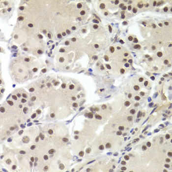 RBPJ Antibody - Immunohistochemistry of paraffin-embedded Human gastric tissue.