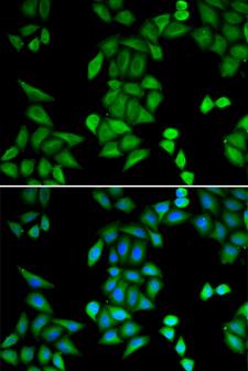 RBPJ Antibody - Immunofluorescence analysis of MCF-7 cells.