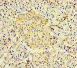 RBPJ Antibody - Immunohistochemistry of paraffin-embedded human pancreatic tissue at dilution of 1:100
