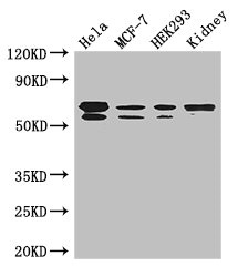 RBPJ Antibody - Western Blot Positive WB detected in:Hela whole cell lysate,MCF-7 whole cell lysate,HEK293 whole cell lysate,Mouse kidney tissue All Lanes: RBPJ antibody at 3.5ug/ml Secondary Goat polyclonal to rabbit IgG at 1/50000 dilution Predicted band size: 56,48,46,55,52 kDa Observed band size: 56,55 kDa