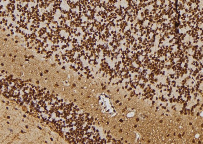 RBPJ Antibody - 1:100 staining rat brain tissue by IHC-P. The sample was formaldehyde fixed and a heat mediated antigen retrieval step in citrate buffer was performed. The sample was then blocked and incubated with the antibody for 1.5 hours at 22°C. An HRP conjugated goat anti-rabbit antibody was used as the secondary.