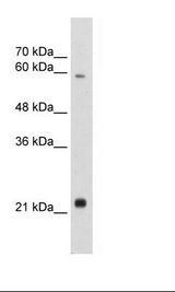 RBPJL Antibody - Jurkat Cell Lysate.  This image was taken for the unconjugated form of this product. Other forms have not been tested.
