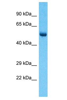 RBPJL Antibody - RBPJL antibody Western Blot of Lymph Tumor. Antibody dilution: 1 ug/ml.  This image was taken for the unconjugated form of this product. Other forms have not been tested.