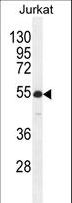 RBPJL Antibody - RBPJL Antibody western blot of Jurkat cell line lysates (35 ug/lane). The RBPJL antibody detected the RBPJL protein (arrow).