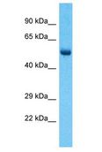 RBPJL Antibody - RBPJL antibody Western Blot of Lymph Tumor. Antibody dilution: 1 ug/ml.  This image was taken for the unconjugated form of this product. Other forms have not been tested.