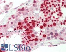 RBPMS / Hermes Antibody - Human Testis: Formalin-Fixed, Paraffin-Embedded (FFPE).  This image was taken for the unconjugated form of this product. Other forms have not been tested.