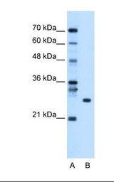 RBPMS / Hermes Antibody - Lane A: Marker. Lane B: HepG2 cell lysate. Antibody concentration: 1.25 ug/ml. Gel concentration: 12%.  This image was taken for the unconjugated form of this product. Other forms have not been tested.