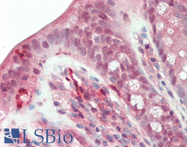 RBPMS / Hermes Antibody - Anti-RBPMS / Hermes antibody IHC staining of human colon. Immunohistochemistry of formalin-fixed, paraffin-embedded tissue after heat-induced antigen retrieval. Antibody concentration 5 ug/ml.  This image was taken for the unconjugated form of this product. Other forms have not been tested.