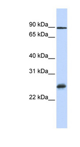 RBPMS / Hermes Antibody - RBPMS antibody Western blot of MCF7 cell lysate.  This image was taken for the unconjugated form of this product. Other forms have not been tested.