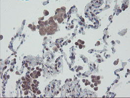 RBPMS / Hermes Antibody - IHC of paraffin-embedded Human lung tissue using anti-RBPMS mouse monoclonal antibody.