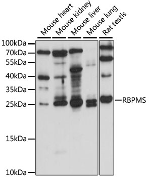 RBPMS / Hermes Antibody - Western blot analysis of extracts of various cell lines, using RBPMS antibody at 1:1000 dilution. The secondary antibody used was an HRP Goat Anti-Rabbit IgG (H+L) at 1:10000 dilution. Lysates were loaded 25ug per lane and 3% nonfat dry milk in TBST was used for blocking. An ECL Kit was used for detection and the exposure time was 90s.