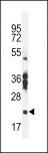 RBPMS2 Antibody - RBPMS2 Antibody western blot of mouse stomach tissue lysates (35 ug/lane). The RBPMS2 antibody detected the RBPMS2 protein (arrow).
