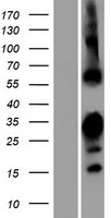 RBPMS2 Protein - Western validation with an anti-DDK antibody * L: Control HEK293 lysate R: Over-expression lysate