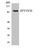 RBSN / Rabenosyn 5 Antibody - Western blot analysis of the lysates from COLO205 cells using ZFYVE20 antibody.