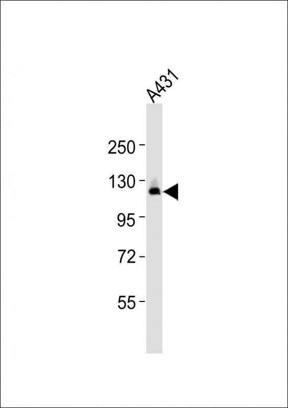 RBSN / Rabenosyn 5 Antibody - Anti-ZFYVE20 Antibody at 1:2000 dilution + A431 whole cell lysates Lysates/proteins at 20 ug per lane. Secondary Goat Anti-Rabbit IgG, (H+L), Peroxidase conjugated at 1/10000 dilution Predicted band size : 89 kDa Blocking/Dilution buffer: 5% NFDM/TBST.