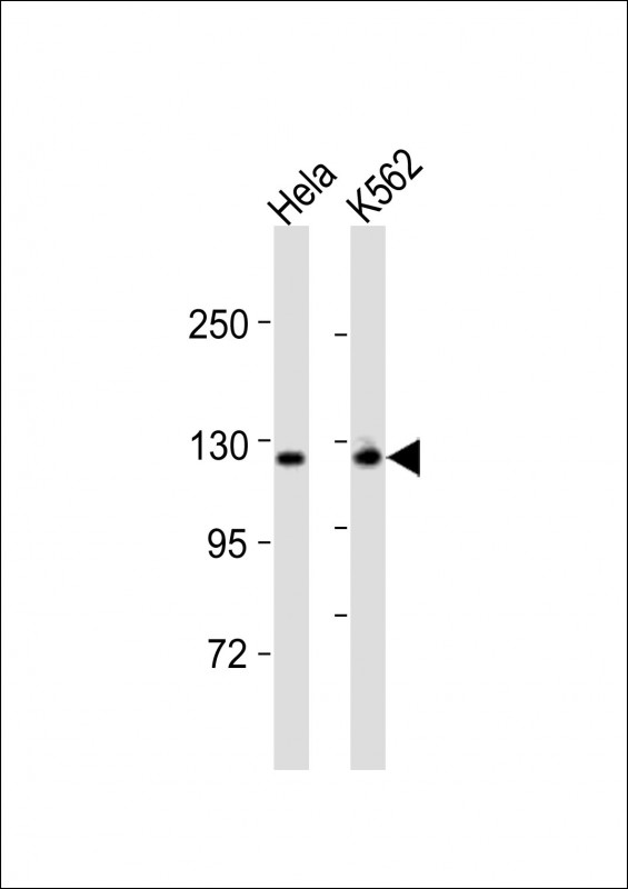 RBSN / Rabenosyn 5 Antibody - All lanes : Anti-ZFYVE20 Antibody at 1:8000 dilution Lane 1: HeLa whole cell lysates Lane 2: K562 whole cell lysates Lysates/proteins at 20 ug per lane. Secondary Goat Anti-Rabbit IgG, (H+L), Peroxidase conjugated at 1/10000 dilution Predicted band size : 89 kDa Blocking/Dilution buffer: 5% NFDM/TBST.