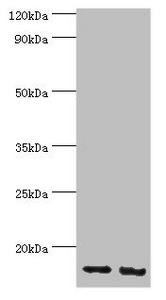 RBX1 / ROC1 Antibody - Western blot All lanes: E3 ubiquitin-protein ligase RBX1 antibody at 4µg/ml Lane 1: Hela whole cell lysate Lane 2: HepG2 whole cell lysate Secondary Goat polyclonal to rabbit IgG at 1/10000 dilution Predicted band size: 12 kDa Observed band size: 12 kDa