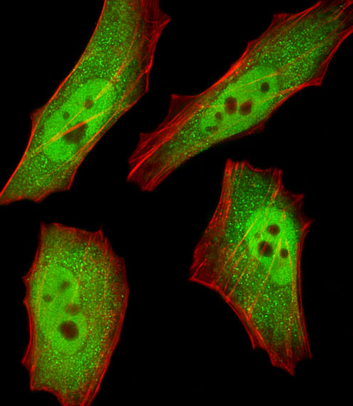 RBX1 / ROC1 Antibody - Fluorescent image of HeLa cells stained with RBX1 Antibody. Antibody was diluted at 1:25 dilution. An Alexa Fluor 488-conjugated goat anti-rabbit lgG at 1:400 dilution was used as the secondary antibody (green). Cytoplasmic actin was counterstained with Alexa Fluor 555 conjugated with Phalloidin (red).