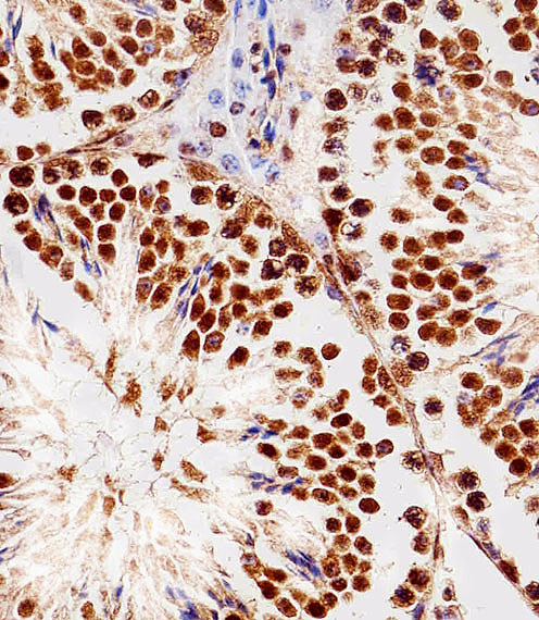 RBX1 / ROC1 Antibody - Immunohistochemical of paraffin-embedded M. testis section using RBX1 Antibody. Antibody was diluted at 1:100 dilution. A peroxidase-conjugated goat anti-rabbit IgG at 1:400 dilution was used as the secondary antibody, followed by DAB staining.