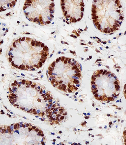 RBX1 / ROC1 Antibody - Immunohistochemical of paraffin-embedded H. colon section using RBX1 Antibody. Antibody was diluted at 1:100 dilution. A peroxidase-conjugated goat anti-rabbit IgG at 1:400 dilution was used as the secondary antibody, followed by DAB staining.