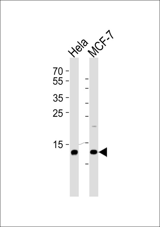 RBX1 / ROC1 Antibody - Western blot of lysates from HeLa, MCF-7 cell line (from left to right) with RBX1 Antibody. Antibody was diluted at 1:1000 at each lane. A goat anti-rabbit IgG H&L (HRP) at 1:5000 dilution was used as the secondary antibody. Lysates at 35 ug per lane.