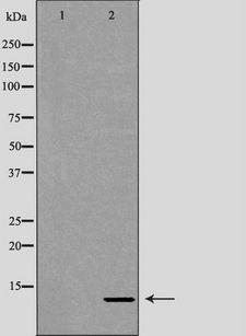 RBX1 / ROC1 Antibody - Western blot analysis of HeLa whole cells lysates using RBX1 antibody. The lane on the left is treated with the antigen-specific peptide.