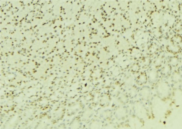 RBX1 / ROC1 Antibody - 1:100 staining human gastric tissue by IHC-P. The sample was formaldehyde fixed and a heat mediated antigen retrieval step in citrate buffer was performed. The sample was then blocked and incubated with the antibody for 1.5 hours at 22°C. An HRP conjugated goat anti-rabbit antibody was used as the secondary.