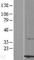 RBX1 / ROC1 Protein - Western validation with an anti-DDK antibody * L: Control HEK293 lysate R: Over-expression lysate