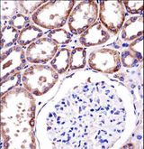 RC3H1 / ROQUIN Antibody - RC3H1 Antibody immunohistochemistry of formalin-fixed and paraffin-embedded human kidney tissue followed by peroxidase-conjugated secondary antibody and DAB staining.