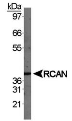 RCAN1 / DSCR1 Antibody - RCAN1 Antibody - Western blot of RCAN in human fetal brain.  This image was taken for the unconjugated form of this product. Other forms have not been tested.