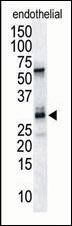 RCAN1 / DSCR1 Antibody - The anti-DSCR1 antibody is used in Western blot to detect DSCR1 in endothelial tissue lysate.