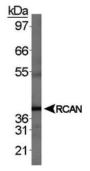 RCAN1 / DSCR1 Antibody - RCAN1 Antibody - Western blot of RCAN1 in human fetal brain.  This image was taken for the unconjugated form of this product. Other forms have not been tested.