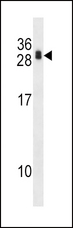 RCAN1 / DSCR1 Antibody - RCAN1 Antibody western blot of 293 cell line lysates (35 ug/lane). The RCAN1 antibody detected the RCAN1 protein (arrow).