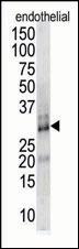 RCAN1 / DSCR1 Antibody - The anti-DSCR1 antibody is used in Western blot to detect DSCR1 in endothelial cell lysate.